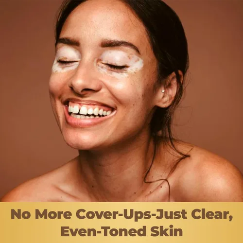 Vista 5 de Dermawonder - Cápsulas de vitiligo (60 unidades) Suplemento eficaz de vitíligo, reduce las manchas blancas y mejora el apoyo de la pigmentación