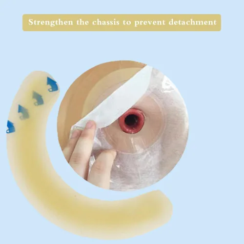 Vista 4 de 20PCS Ostomía Suministros Ostomía Barrera Tiras de Barrera Elástico para Bolsas de Colostomía