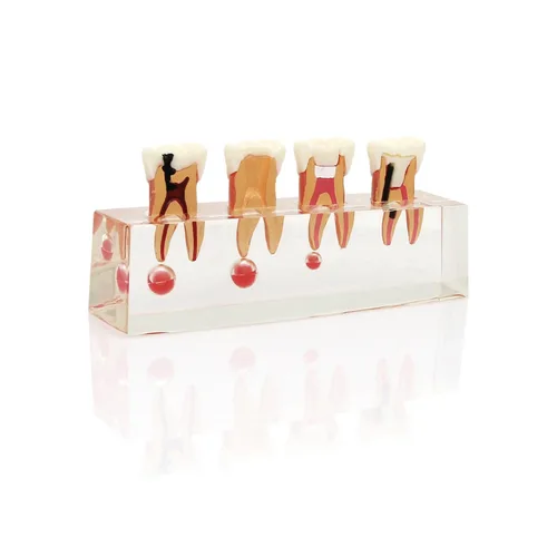 Vista 4 de Modelo de tratamiento endodóntico Dentalmall, de cuatro etapas, para enseñar a estudiantes, modelo 4018
