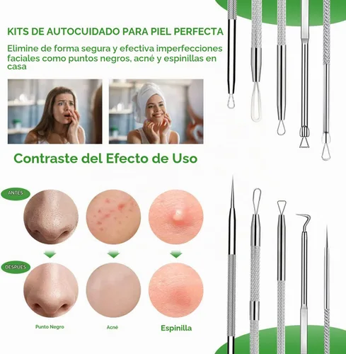 Vista 3 de Kit de herramientas para reventar espinillas, herramienta para eliminar puntos negros, 5 piezas, herramienta extractora de puntos negros para cara