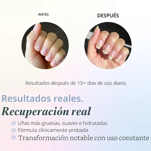Vista 2 de Sistema de crecimiento de uñas dURI Rejuvacote, de 61 onzas