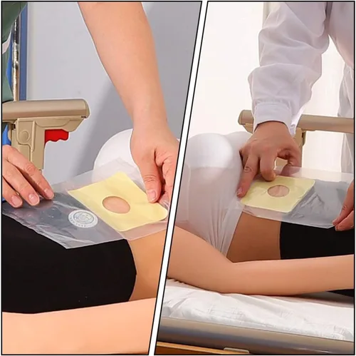 Vista 5 de EXCEART Bolsa de ostomía desechable de plástico transparente para iseostomía, bolsa de cuidado de ileostomía, bolsa de cuidado de ileostomía, 60 uds