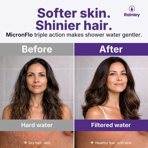 Vista 2 de Filtro de ducha Bossa para agua dura – Elimina sustancias químicas tóxicas, cloro y metales pesados A nivel de micrones Anti-obstrucción de alta
