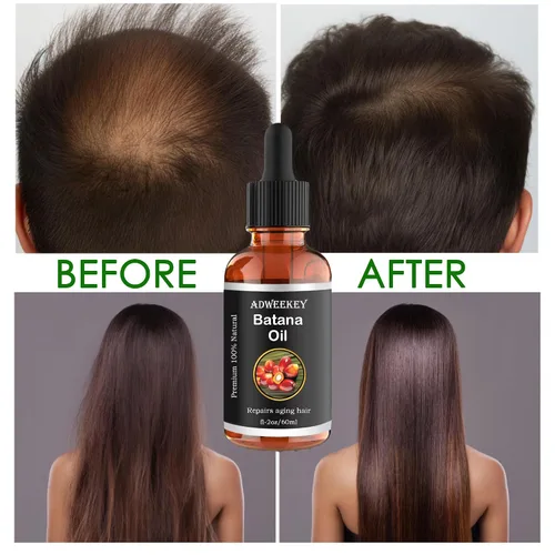 Vista 7 de Aceite de batana orgánico para el crecimiento del cabello, 100% puro, promueve el bienestar del cabello para hombres y mujeres, mejora el brillo