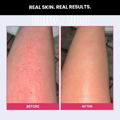 Vista 4 de Borrador exfoliante suavizante de golpes Para piel áspera y con baches con espirulina, ácido glicólico y ácido láctico para hombres y mujeres