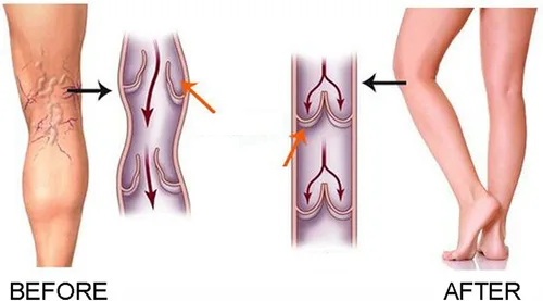 Vista 6 de Medias de compresión médicas para mujer 15-20mmhg Calcetines Manga de pantorrilla