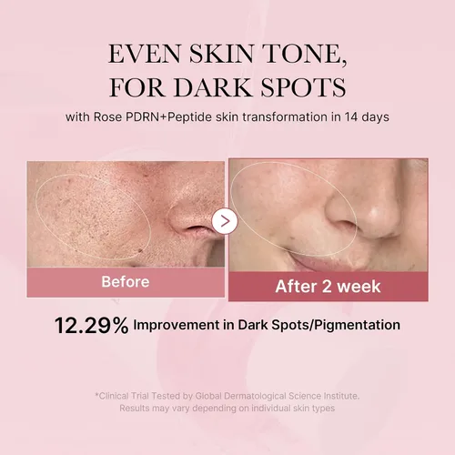 Vista 2 de medicube PDRN Toner Rose PDRN Peptide Toner Tipo ligero y acuoso para estimular la piel, calmante y calmante, tono de piel desigual con rosa