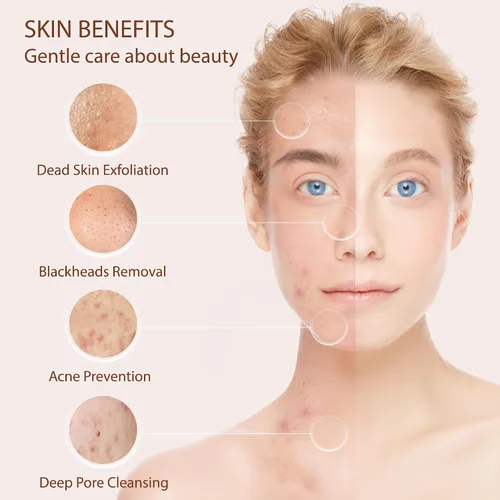Vista 4 de Cepillo de Limpieza Facial Exfoliante para el Rostro Limpiador Exfoliante para el Cuidado de la Piel Lavado para Mujeres Niñas Exfoliante Eléctrico