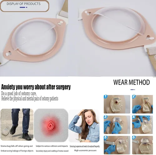 Vista 7 de Protector de estoma Escudo de seguridad Refuerzo de chasis de estoma Cinturón de apoyo ajustable para ostomía, cubierta de bolsa de ostomía