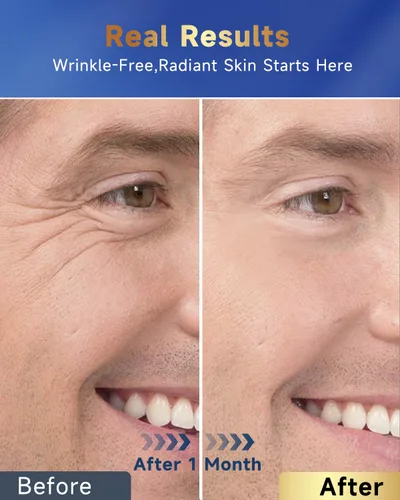 Vista 6 de Felicemy Crema facial 6 en 1 para hombres, humectante facial para hombres, crema facial antienvejecimiento para hombres con retinol colágeno y ácido