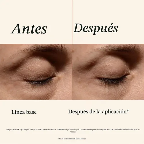 Vista 4 de SkinMedica Instant Bright Eye Cream - Our Age-Defying Under the Eye Cream Instantly Improves Eyes’ Appearance, Including Dark Circles, Sagging