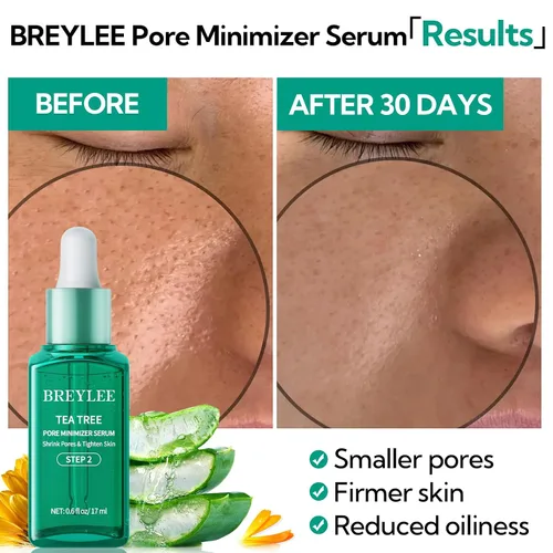 Vista 5 de BREYLEE Máscara eliminadora de puntos negros y suero minimizador de poros, aceite de árbol de té, tiras de poros nasales +100 papeles, control