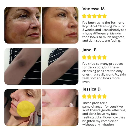 Vista 8 de Almohadillas limpiadoras de ácido kójico de cúrcuma para la cara, esponjas exfoliantes con vitamina C y limón, lavado facial espumoso para una piel