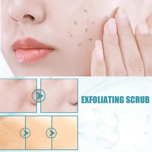 Vista 6 de Papaya Essence - Gel exfoliante iluminador, limpiador exfoliante de esencia de papaya, lavado facial exfoliante, crema exfoliante de papaya, crema