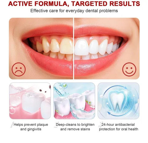 Vista 5 de SP 6 Pasta de dientes blanqueadora probiótica - Fórmula probiótica mejorada - Ilumina tu sonrisa y fortalece la salud bucal
