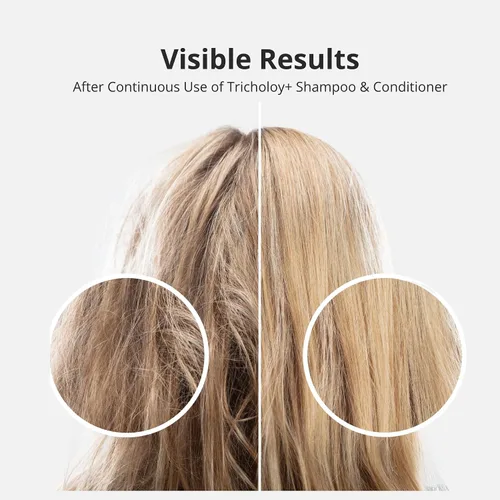 Vista 6 de Champú voluminizador y espesante para cabello fino y fino, fórmula de biotina Root Lift añade cuerpo instantáneo, plenitud y brillo, sin sulfato, 10