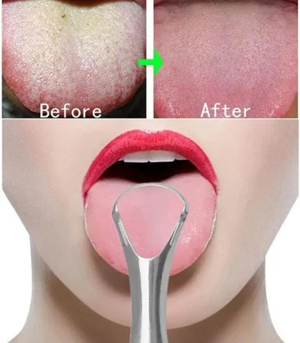 Vista 4 de Raspador de lengua para adultos para reducir el mal aliento, limpiadores de lengua de acero inoxidable, raspador de lengua de metal, limpiador