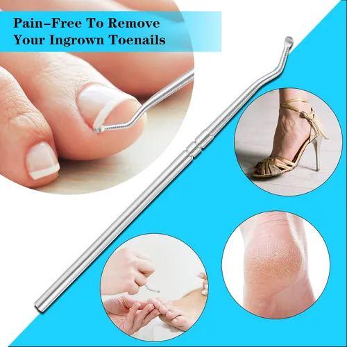 Vista 4 de (50+1) Juego de corrector de uñas encarnadas, kit profesional de eliminación de uñas encarnadas sin dolor con levantador de uñas de los pies, tira