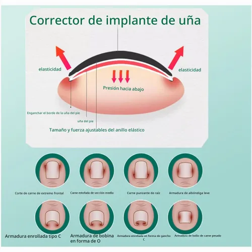 Vista 7 de Kit de corrección de uñas encarnadas Professional Nail Care Tools, Correction Clips and Adhesive Pads, Four Correction Clips, Correct Two Toenails