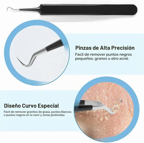 Vista 3 de Herramientas Removedoras de Puntos Negros Kit de Herramientas para Reventar Espinillas, Extractor de Comedones Kit de Eliminación de Acné