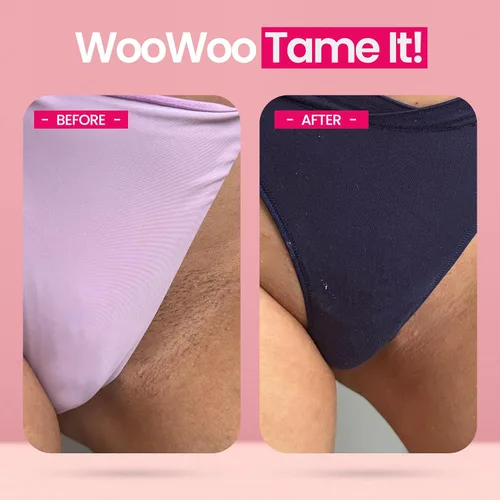 Vista 5 de WooWoo Crema natural de depilación íntima - Removedor de pelo vegano sin dolor para pieles sensibles - Depilatorio para genitales, bikini, piernas