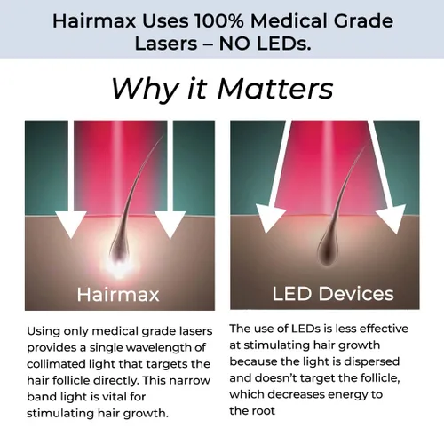 Vista 4 de Hairmax LaserBand 82 - Tratamiento para el Crecimiento y Rebrotes del Cabello - Restaura el Ciclo Natural del Cabello - Dispositivo Médico de Uso