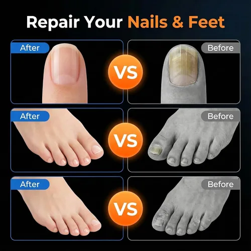 Vista 6 de Tratamiento del espray del pie de los atletas, pluma extra fuerte de la reparación de las uñas del pie Pluma extra fuerte para tratamiento