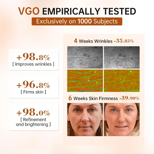 Vista 5 de VGO Suero de retinol para cara, suero de retinol rejuvenecedor con ácido hialurónico, niacinamida y ceramidas, hidratante y refrescante, suavizante