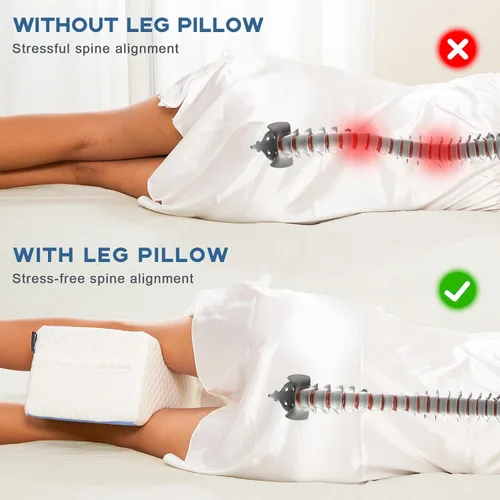 Vista 4 de cooloo8 Almohada para dormir de lado, almohada de rodilla para dormir de lado, almohada para aliviar el dolor de ciática (azul)