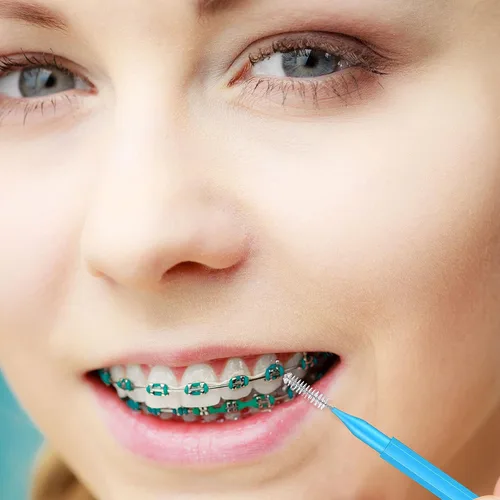 Vista 7 de Nuenen 150 piezas de cepillo interdental, herramienta de limpieza de dientes de dientes para palillos de dientes, limpiador de dientes de cabeza