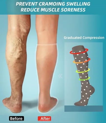 Vista 3 de FuelMeFoot Calcetines de compresión para mujeres y hombres, para circulación, con soporte graduado, hasta la rodilla, para enfermeras, viajes