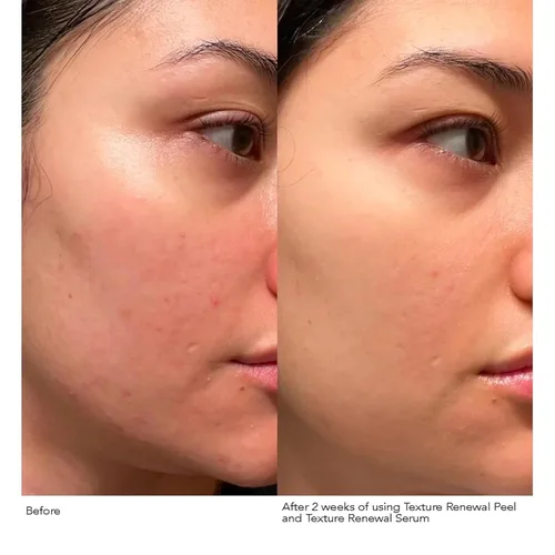 Vista 4 de Dr. Dennis Gross Advanced Retinol + Ferulic Texture Renewal Serum - Fórmula antienvejecimiento para suavizar la textura, aumentar el brillo