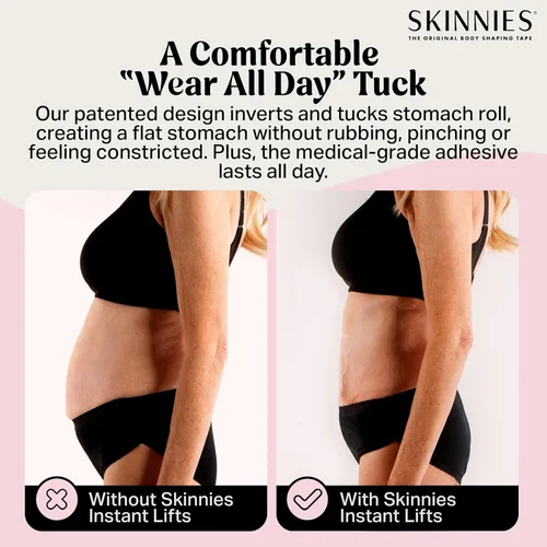 Vista 3 de Skinnies Instant Lifts - Cinta adhesiva para abdominoplastia patentada, fabricada en Estados Unidos, para vientre delgado de 3 a 4 pulgadas al