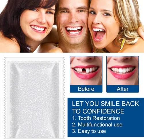 Vista 4 de Kit de reparación de dientes – 1.05 oz de repuesto de dientes con cuentas moldeables de ajuste térmico para la restauración temporal de dientes
