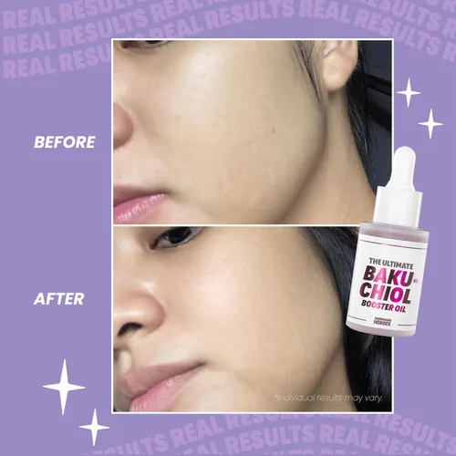 Vista 8 de Ahorra un 15 % en paquete facial de Bakuchiol - Aceite facial de Bakuchiol, exfoliante labial y mascarilla