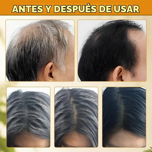 Vista 5 de Atsy Jabón en barra de cabello gris, jabón negro natural para cobertura de cabello gris, barra de champú oscurecimiento con ginseng y sésamo negro