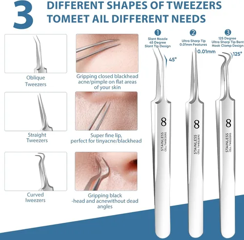 Vista 4 de Kit de herramientas para eliminar puntos negros, herramienta extractora de espinillas, herramienta extractora de espinillas, herramienta profesional