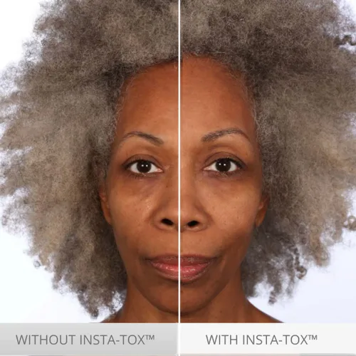 Vista 3 de Serious Skincare INSTA-TOX Suero Instantáneo Alisador de Arrugas - Relleno Facial Mejora la Apariencia de Líneas, Poros y Arrugas Profundas - Tensor