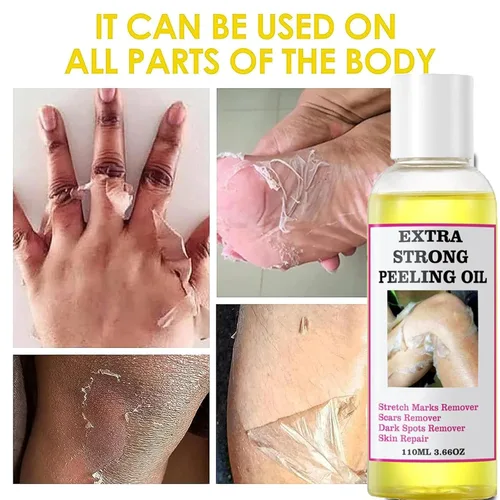 Vista 4 de Generic Aceite pelador amarillo extra fuerte para piel oscura, solución exfoliante para cuerpo, manos, pies y cara, todo