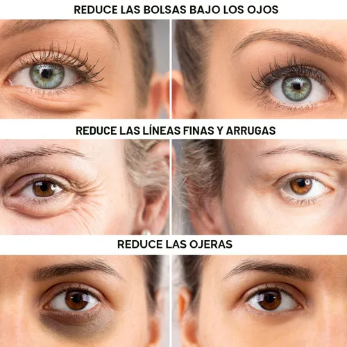 Vista 3 de Apretador instantáneo de ojos: elimina las bolsas debajo de los ojos y la hinchazón. Elimina las ojeras y las arrugas. Crema hidratante naturalmente
