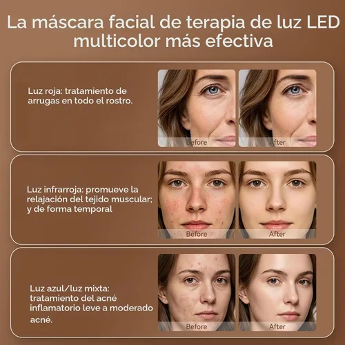 Vista 4 de Terapia de luz roja para cara, terapia de luz de máscara facial LED