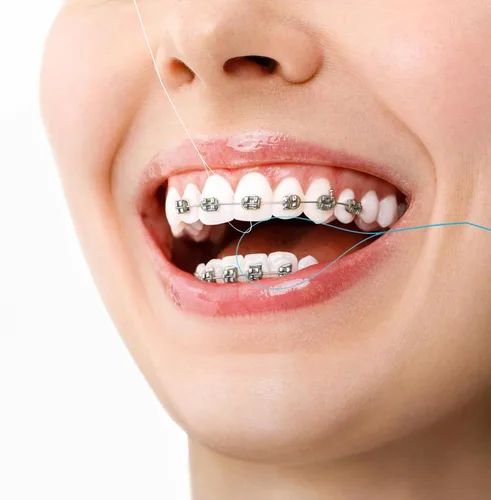 Vista 7 de Amabro Enhebradores de hilo dental, 100 unidades de hilo dental de limpieza profunda para frenos, puentes, implantes, cuidado de la salud oral