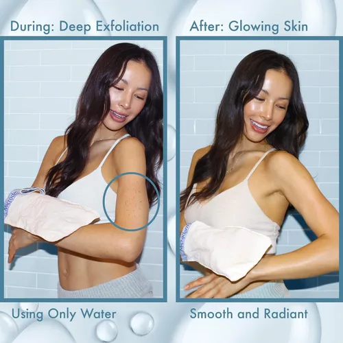 Vista 5 de MicrodermaMitt - Guante exfoliante corporal natural, elimina la piel muerta e impurezas, Mitón del cuerpo