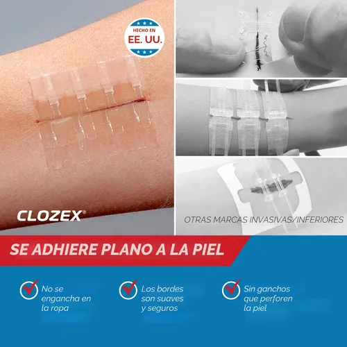 Vista 3 de Clozex Cierres de laceración de emergencia: reparación de heridas sin puntadas. Dispositivo de cierre de piel aprobado por la FDA para 2 heridas