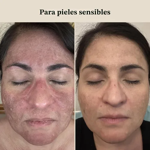 Vista 5 de Roe Wellness - Crema para bebés Ungüento de loción con ingredientes no tóxicos verificados por EWG Barrera del bioma de cuerpo completo Piel