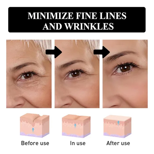 Vista 7 de Snake Peptide Eye Cream,Crema antienvejecimiento para ojeras, hinchazón y arrugas, tratamiento hidratante para ojos con niacinamida y glicerina (1)