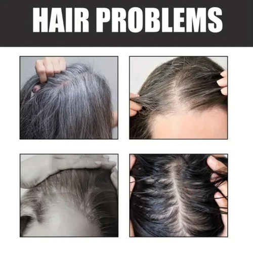 Vista 7 de Jabón para oscurecer el cabello, jabón para el cabello negro con extracto de carbón, raíz de ginseng y semilla de sésamo para suavidad y resplandor