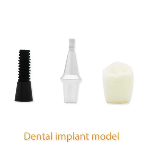 Vista 4 de Modelo de dientes dentales D-IP, modelo de dientes de implante dental transparente Dentista Enfermedad estándar Diente extraíble Modelo de enseñanza