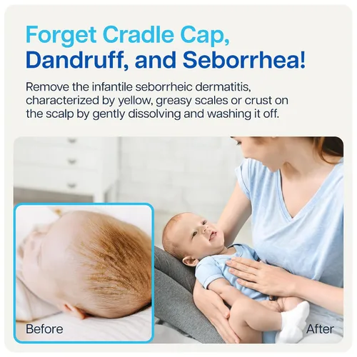 Vista 8 de NAVEH PHARMA Limpiador de tapa de cuna para bebés y niños Tratamiento de tapa de cuna 100% natural Spray y lavado sin fregar Mejor que