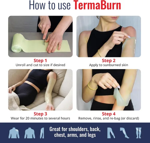 Vista 4 de TermaBurn Envoltura de aloe portátil para aliviar las quemaduras solares: tratamiento después del sol con hidrogel inspirado en el hospital